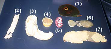 プラスティネーション標本には人体全体および臓器、器官をほぼ原形どおりに標本化するシリコン法と、いろいろな角度方向にスライスされた標本を樹脂に埋め込む方法の２通りがある。