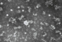 2000年に宮崎で発生した口蹄疫ウイルスの電子顕微鏡写真。均一な大きさの概ね白い六角形の粒子が口蹄疫ウイルス〈写真提供：白井淳資氏〉